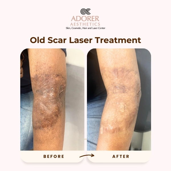 Before After Skin Treatment