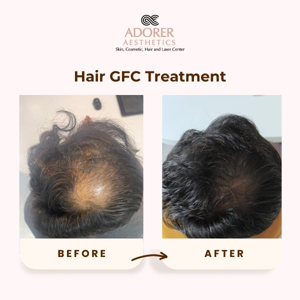 Before After Skin Treatment